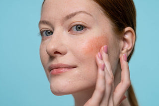Red, Sensitive & Problematic Skin: Natural Solutions to Calm Irritation