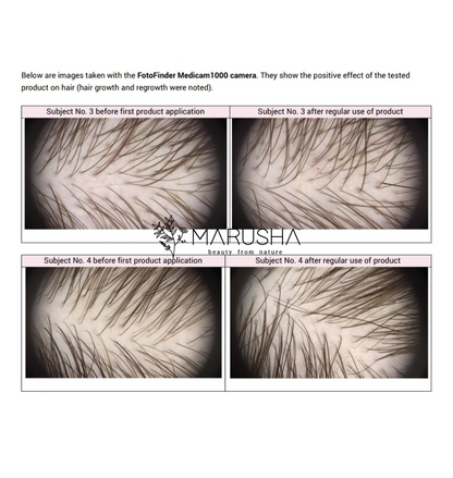 hair growth treatment effect before and after images from  two subjects