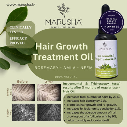 Hair growth treatment rosemary oil 